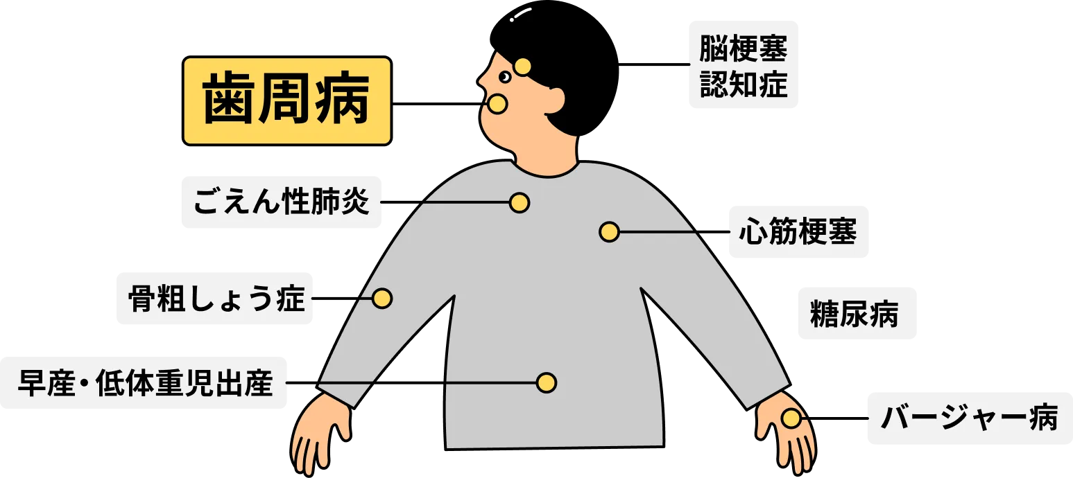 “歯周病と全身疾患の関わり”